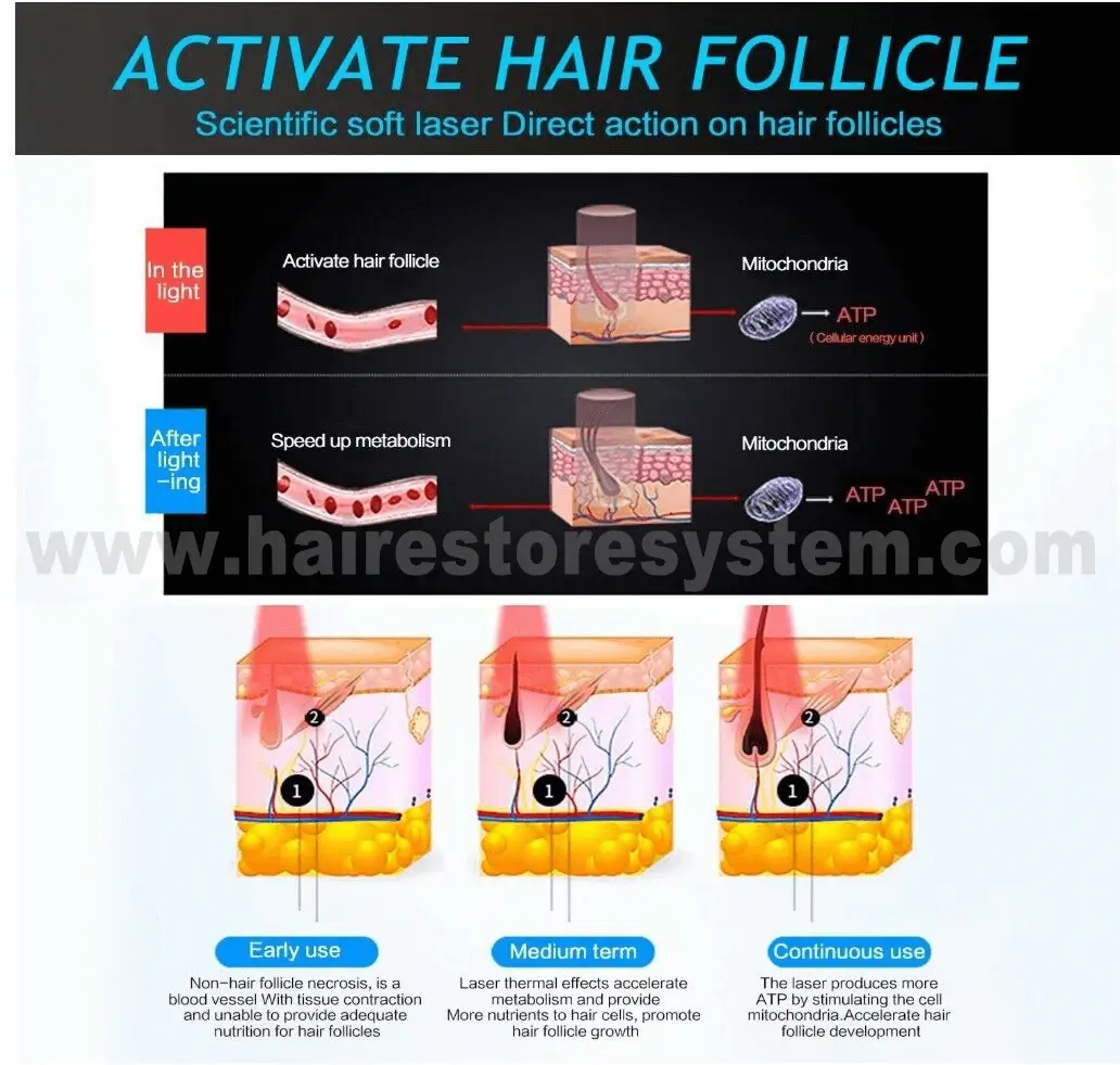 restore-hairg-rowth-system-2